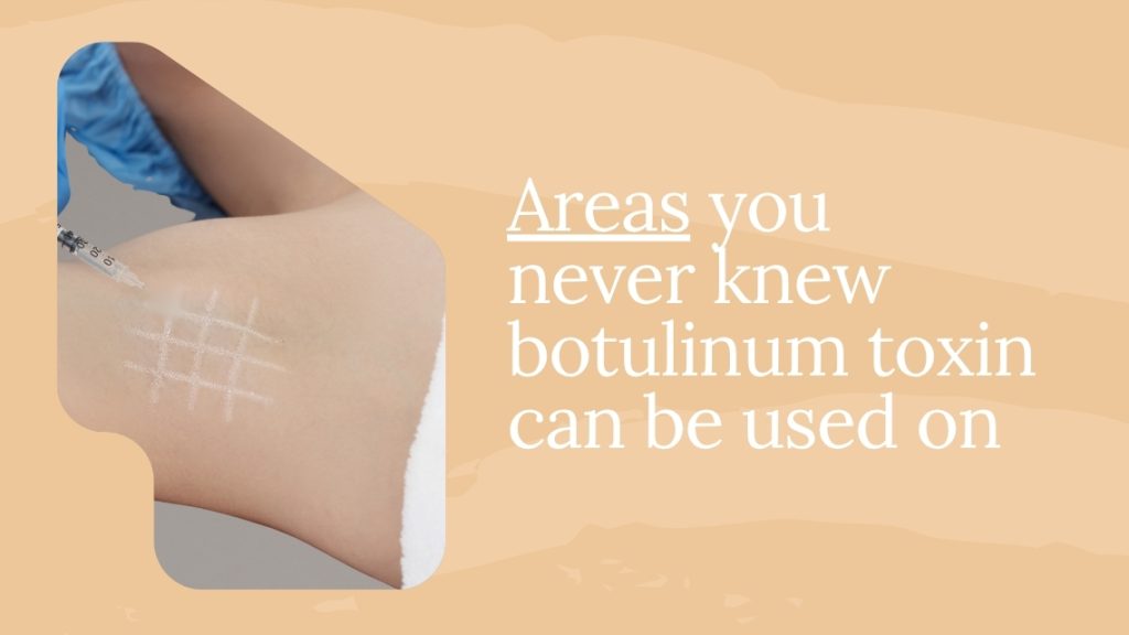 Can Botulinum Toxin Lasts Forever? | Mizu