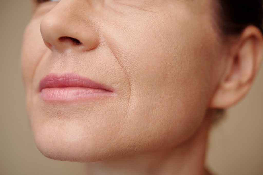 Lines and Wrinkles | Mizu