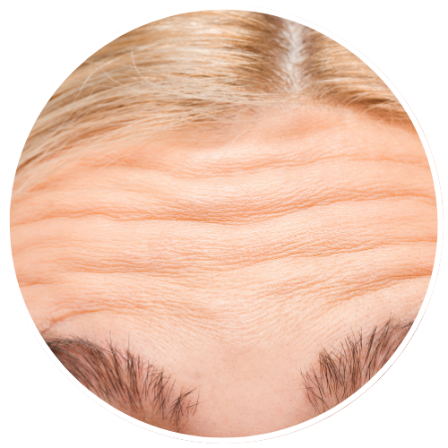 Lines & Wrinkles - Dynamic Wrinkles | Mizu