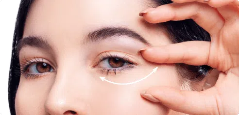 Undereye Fillers - Dark Eye Circles Treatment | Mizu