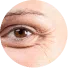 Botulinum Toxin Image | Mizu