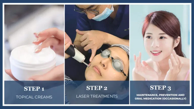 An Honest Doctor's Guide to Treating Pigmentation | Mizu